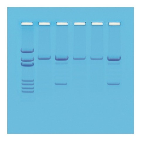 유전자 변형 생물 진단실험